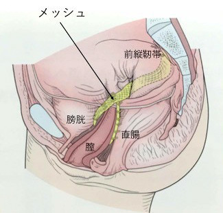 女性泌尿器 – 山梨大学大学院医学工学総合研究部 泌尿器科学・泌尿器科